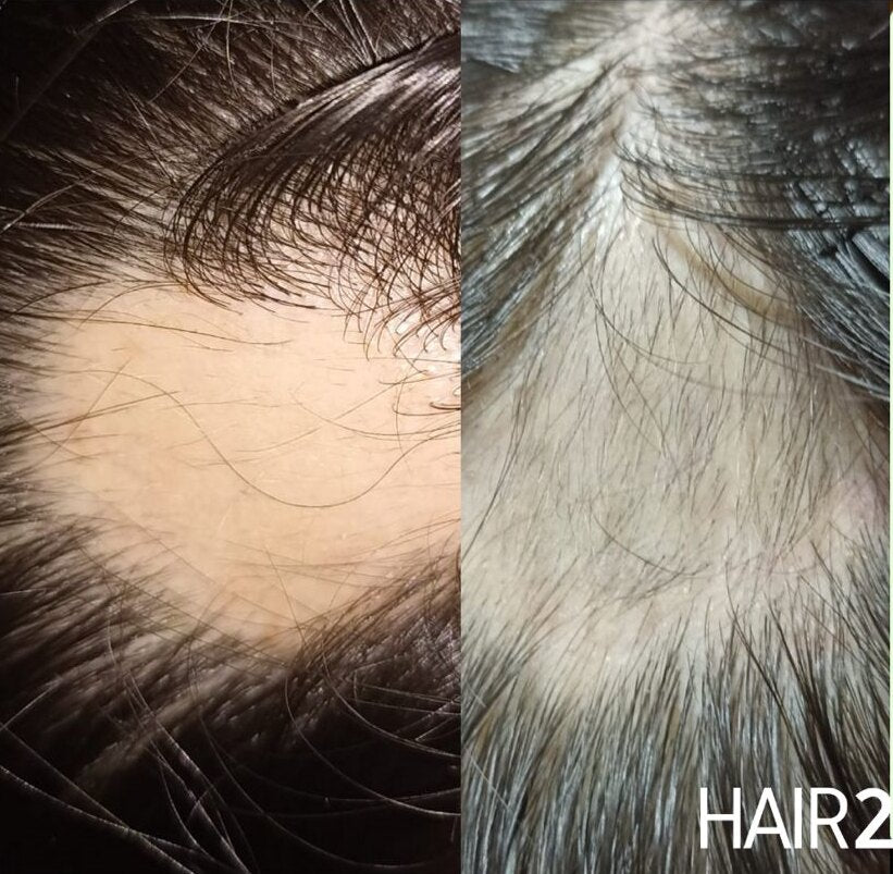 Detalle de baby hairs y nuevo crecimiento capilar
