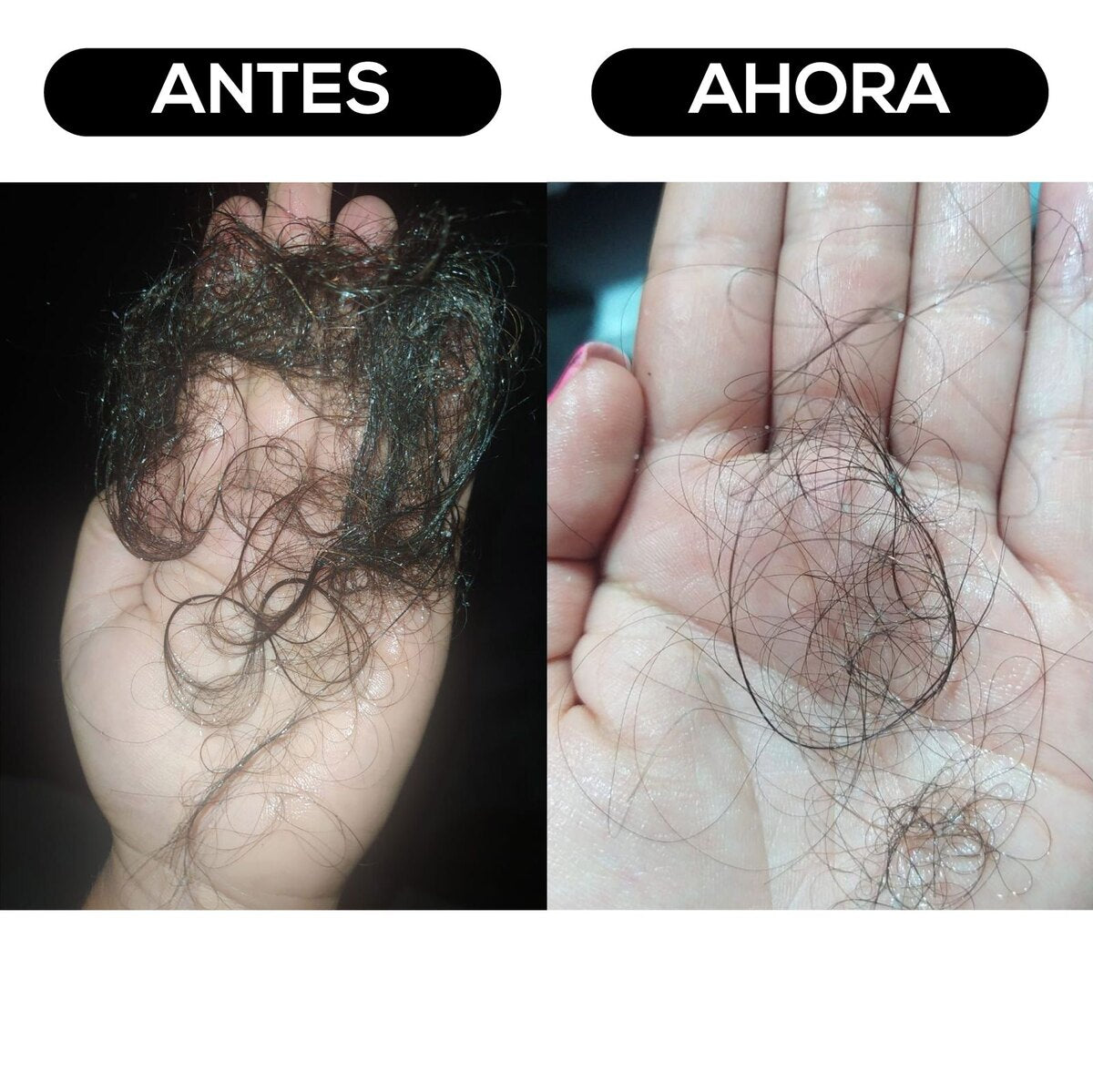 Antes y despues real de crecimiento capilar con Kit Tuyu